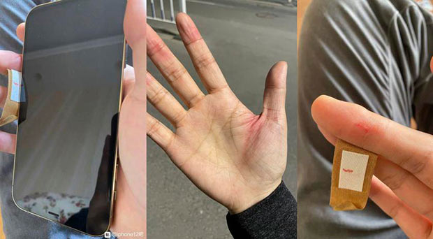 Пользователь iPhone 12 пожаловался, что порезал руки о свой смартфон