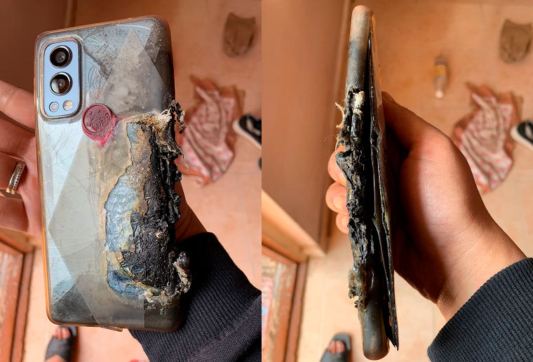OnePlus Nord 2 взорвался в кармане, нанеся серьезнейший ожог