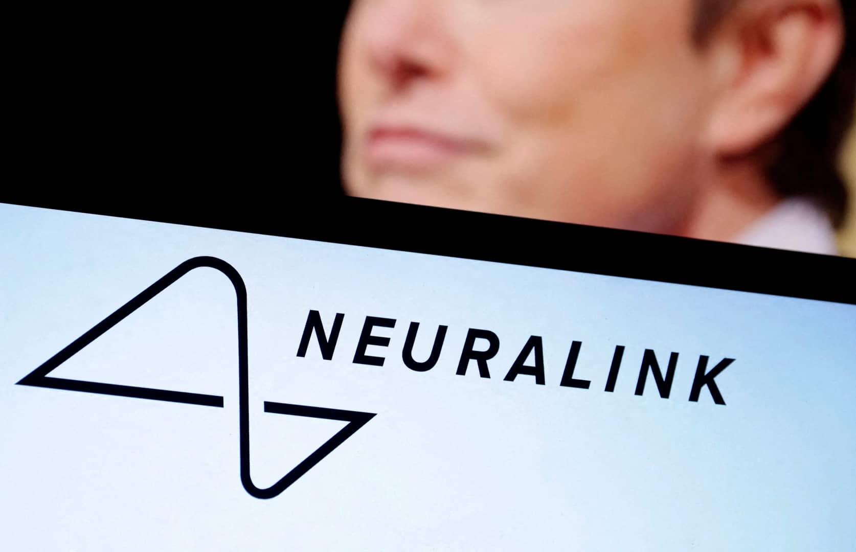 Neuralink вживила нейрочип у мозок другого пацієнта