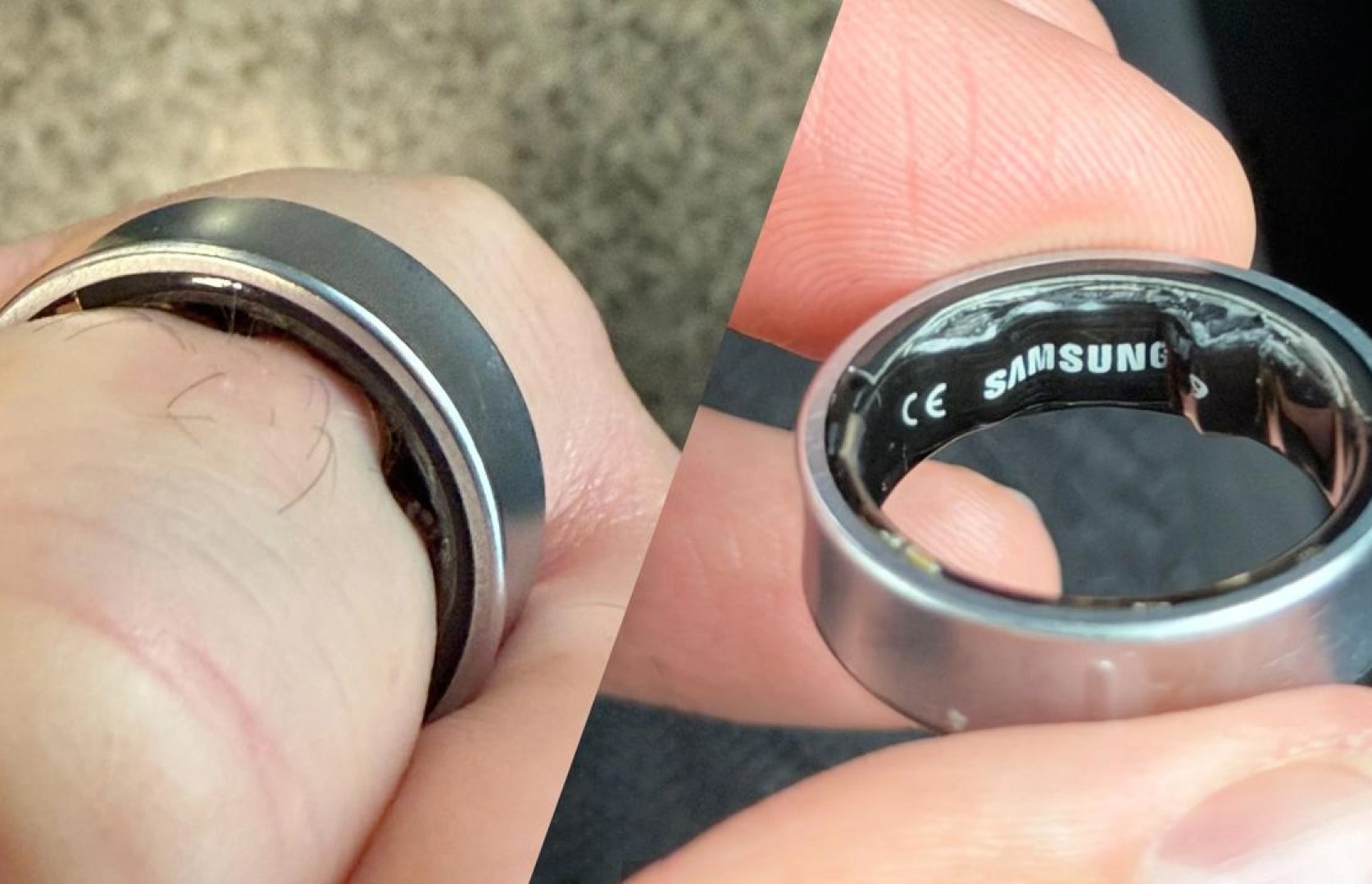 Батарея в кільці Galaxy Ring здулася на пальці в одного з користувачів